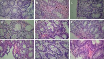 The effect of montelukast, a leukotriene receptor antagonist, on the acetic acid-induced model of colitis in rats: Involvement of NO-cGMP-KATP channels pathway